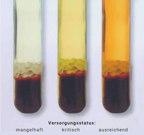 beta carotin blutplasma beta carotin blutplasma